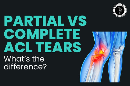 partial vs complete acl tears